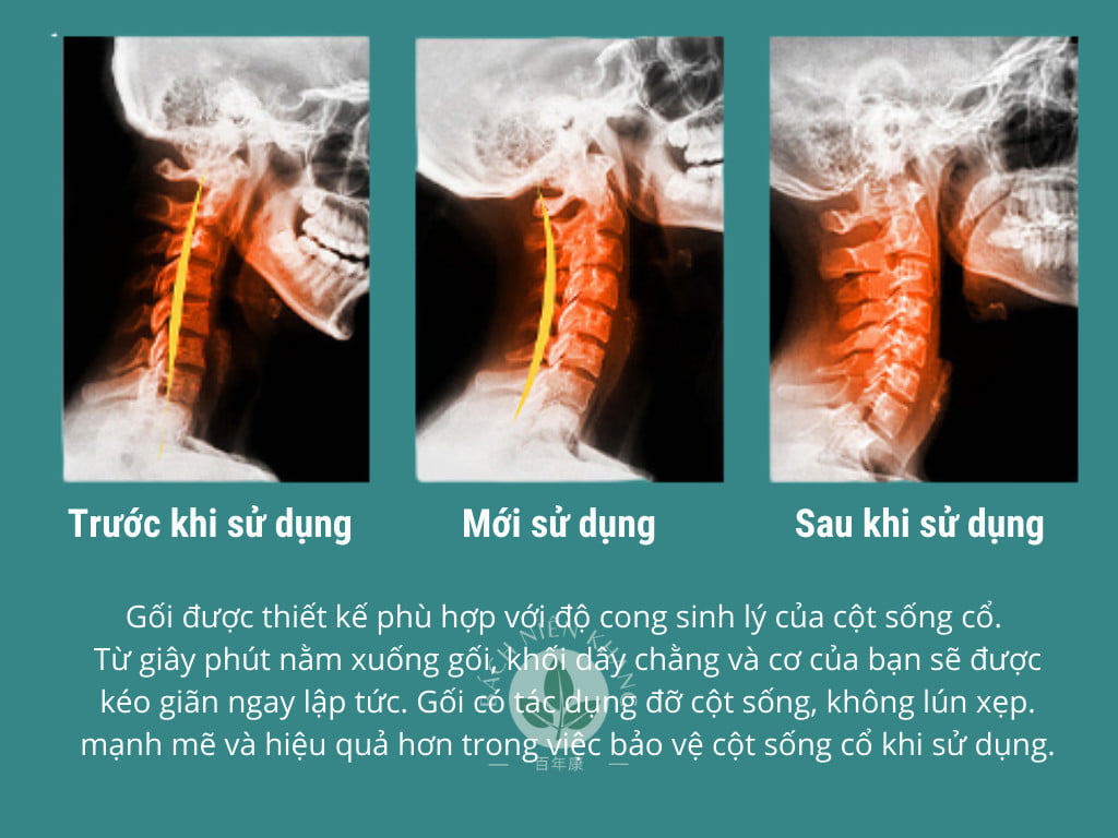 Cây ngải cứu - vị thuốc Đông y tuyệt vời bạn cần biết