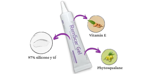 Chữa trị sẹo bằng vật lý trị liệu