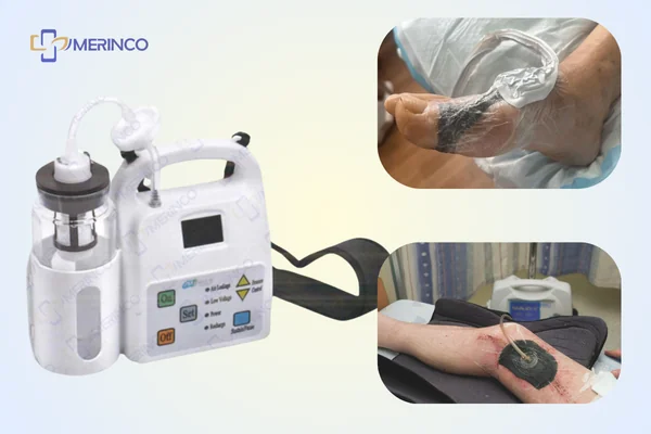 máy hút áp lực âm VAC