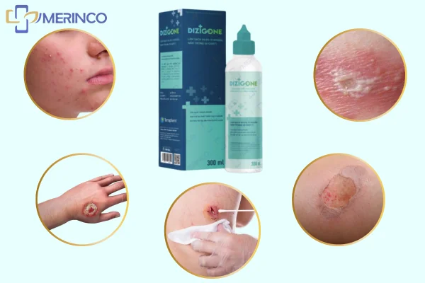 Rửa vết thương Dizigone