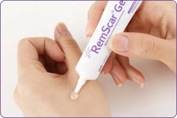 Hướng dẫn sử dụng Gel trị sẹo RemScar