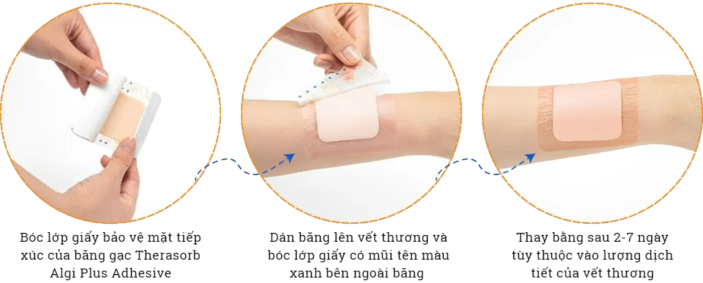 Băng gạc xốp Therasorb Algi Plus Adhesive không dính vào vết thương
