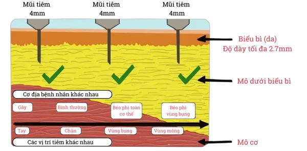 Bạn có cần phải véo da khi tiêm insulin không?