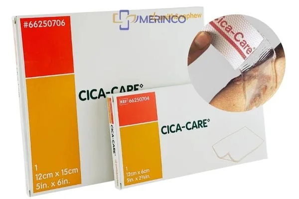 Top 4 miếng dán trị sẹo lồi hiệu quả nhất hiện nay