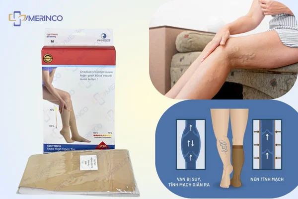 Vớ chống giãn tĩnh mạch Cody