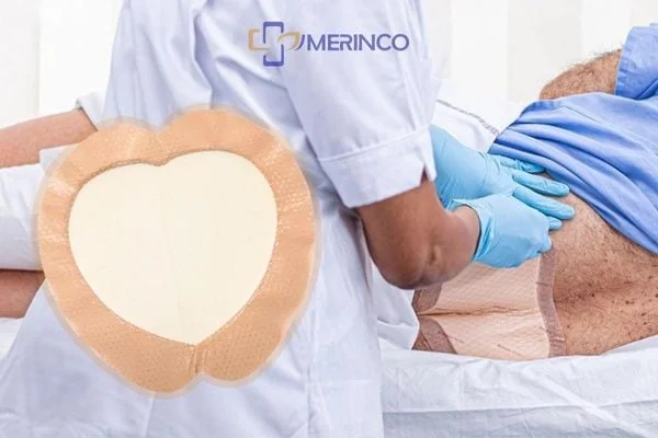 Cách điều trị và phòng ngừa loét da