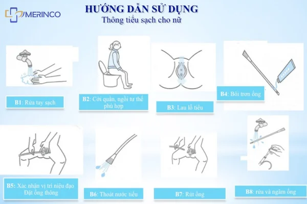 Cách đặt thông tiểu ngắt quãng cho nữ