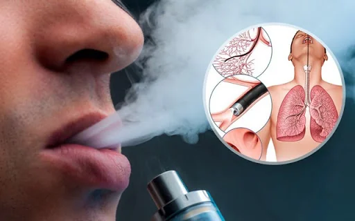 Bộ trưởng Bộ Y tế: Tại Việt Nam, mỗi năm có ít nhất 40.000 ca tử vong do các bệnh liên quan đến thuốc lá- Ảnh 5. Bộ trưởng Bộ Y tế: Tại Việt Nam, mỗi năm có ít nhất 40.000 ca tử vong do các bệnh liên quan đến thuốc lá- Ảnh 5.