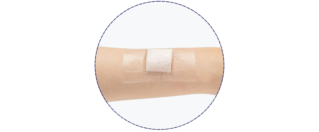 Hướng dẫn sử dụng Gạc xốp bạc kháng khuẩn Therasorb Ag Plus