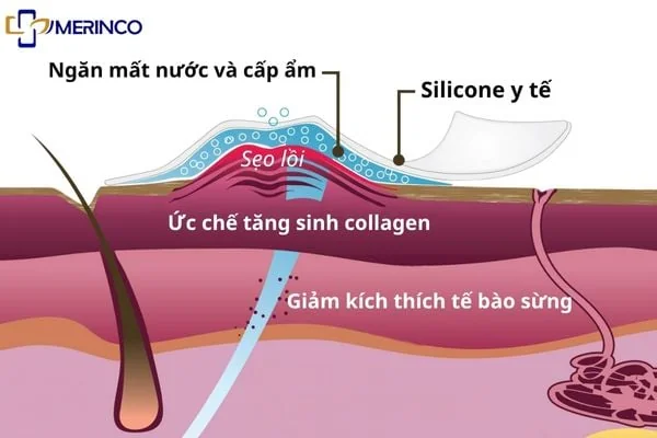 Sẹo lồi hay ngứa do đâu? Có trị hết được không?