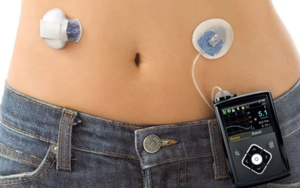 7 cải tiến đã và đang thay đổi cách chữa trị và quản lý tiểu đường tuýp 2