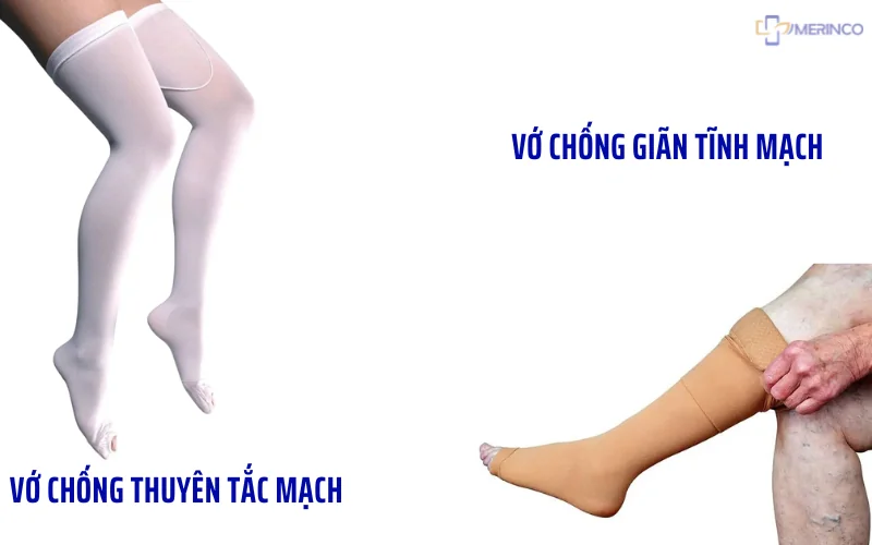 so sánh vớ