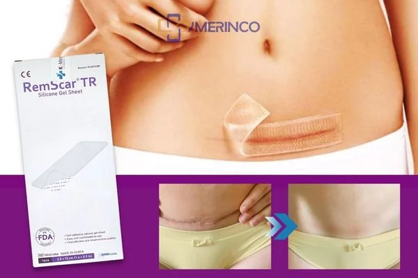Review miếng dán trị sẹo RemScar TR sau 2 tháng sử dụng