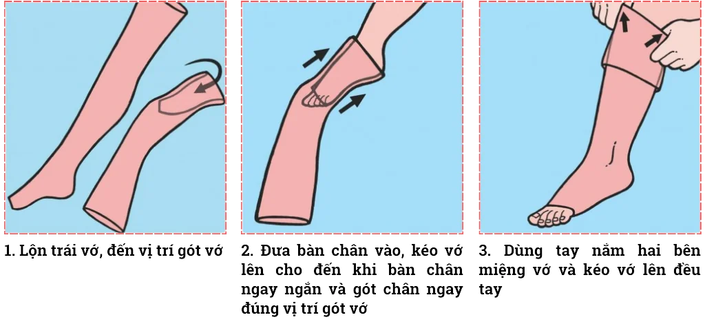 Hướng dẫn sử dụng vớ y khoa giãn tĩnh mạch Cody (Vớ gối)