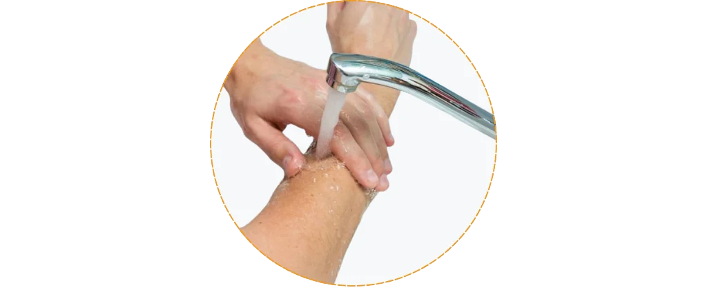 Hướng dẫn sử dụng Gạc xốp vết thương Therasorb Algi Plus Hydrophilic