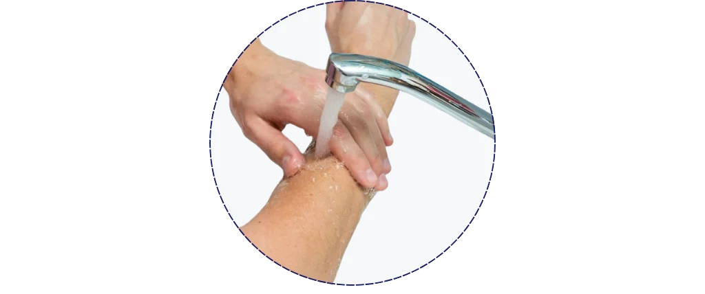 Hướng dẫn sử dụng Gạc xốp bạc kháng khuẩn Therasorb Ag Plus