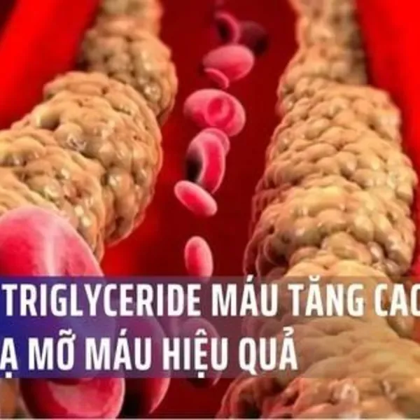 Vì Sao Triglyceride Máu Tăng Cao? Cách Hạ Mỡ Máu Hiệu Quả