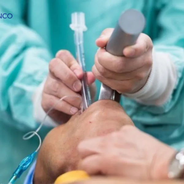 Đặt nội khí quản là gì: Tổng quan, Lợi ích và Kết quả