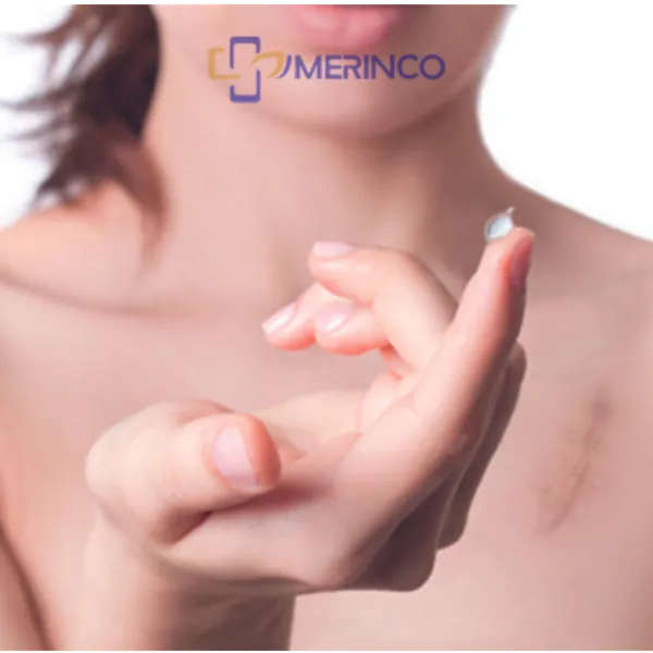 Cách trị sẹo lồi mới hình thành bằng Gel Silicone