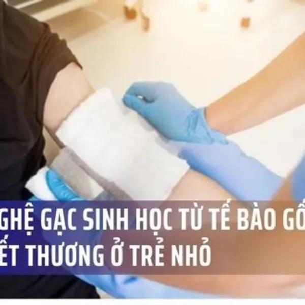 Công Nghệ Gạc Sinh Học Mới Từ Tế Bào Gốc: Giải Pháp Cho Vết Thương Khó Lành Ở Trẻ Nhỏ