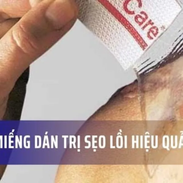 Top 4 miếng dán trị sẹo lồi hiệu quả nhất hiện nay