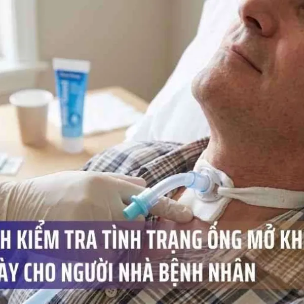 Quy trình kiểm tra tình trạng ống mở khí quản hàng ngày cho người nhà bệnh nhân
