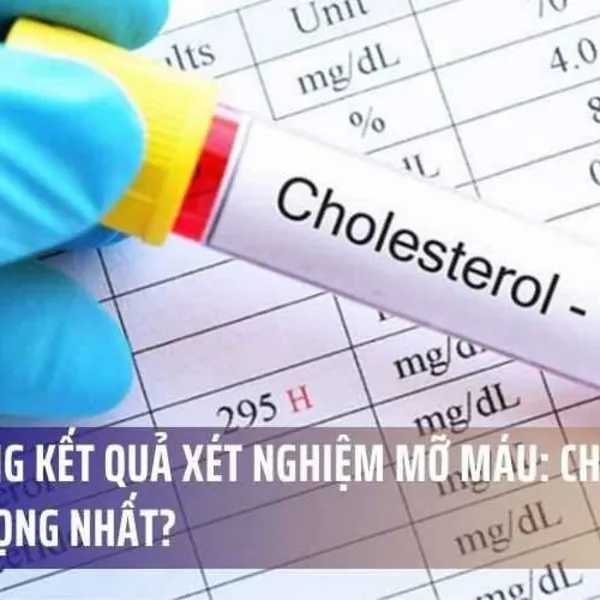 Hiểu Đúng Kết Quả Xét Nghiệm Mỡ Máu: Chỉ Số Nào Quan Trọng Nhất?